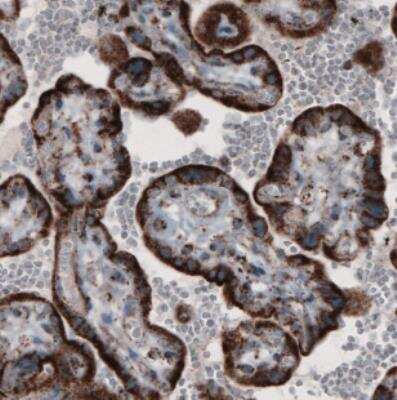 Immunohistochemistry: CS Citrate Synthase Antibody (CL2579) [NBP2-36775]