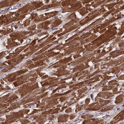 Immunohistochemistry-Paraffin: CS Citrate Synthase Antibody [NBP2-13877]