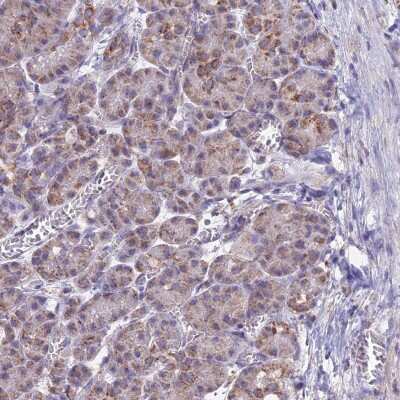 Immunohistochemistry-Paraffin: CS Citrate Synthase Antibody [NBP2-13877]