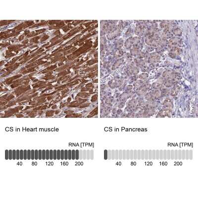 Immunohistochemistry-Paraffin: CS Citrate Synthase Antibody [NBP2-13877]