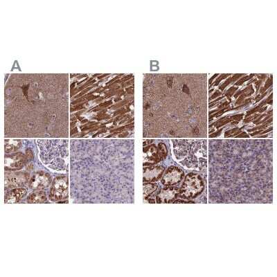 Immunohistochemistry-Paraffin: CS Citrate Synthase Antibody [NBP2-13877]