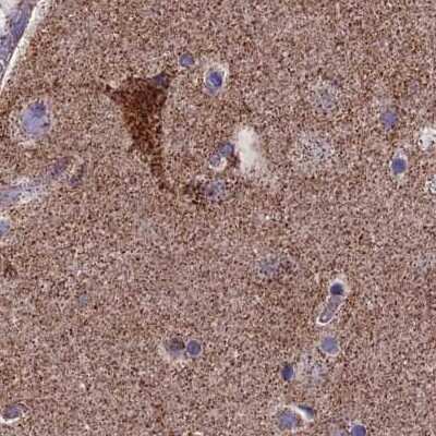 Immunohistochemistry-Paraffin: CS Citrate Synthase Antibody [NBP2-13877]