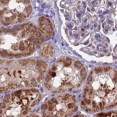 Immunohistochemistry-Paraffin: CS Citrate Synthase Antibody [NBP2-13877]