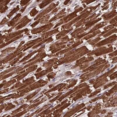 Immunohistochemistry-Paraffin: CS Citrate Synthase Antibody [NBP2-13878]