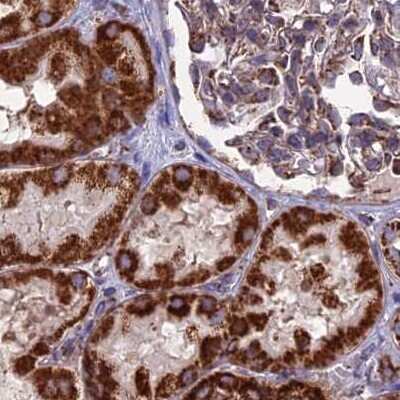 Immunohistochemistry-Paraffin: CS Citrate Synthase Antibody [NBP2-13878]