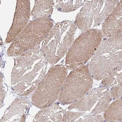 Immunohistochemistry-Paraffin: CS Citrate Synthase Antibody [NBP2-13878]