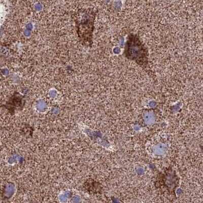 Immunohistochemistry-Paraffin: CS Citrate Synthase Antibody [NBP2-13878]