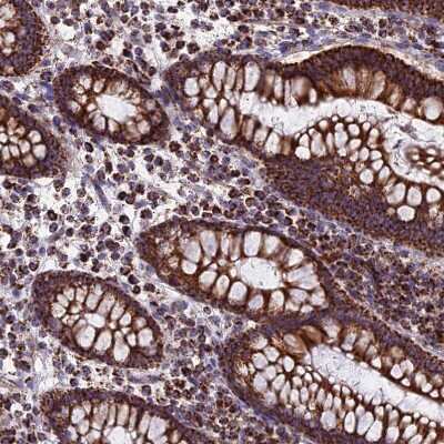 Immunohistochemistry-Paraffin: CS Citrate Synthase Antibody [NBP2-13878]