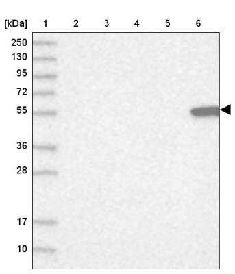 Western Blot: CS Citrate Synthase Antibody [NBP2-13878]