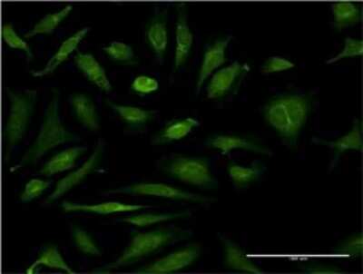 Immunocytochemistry/ Immunofluorescence: CSAD Antibody (2C11) [H00051380-M02]