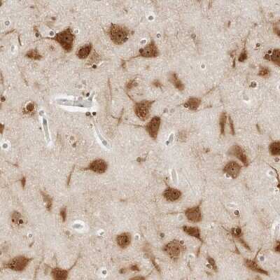 Immunohistochemistry-Paraffin: CSAP Antibody [NBP1-83446]