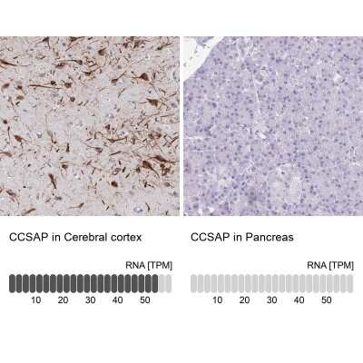 Immunohistochemistry-Paraffin: CSAP Antibody [NBP2-33394]