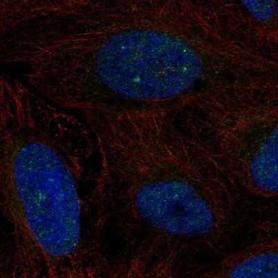Immunocytochemistry/ Immunofluorescence: CSB Antibody [NBP2-68917]