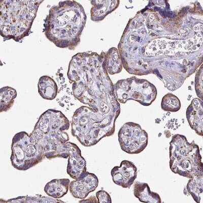 Immunohistochemistry-Paraffin: CSDE1 Antibody [NBP2-38665]