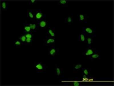 Immunocytochemistry/ Immunofluorescence: CSE1L/CAS/Exportin-2 Antibody (1E4) [H00001434-M02]