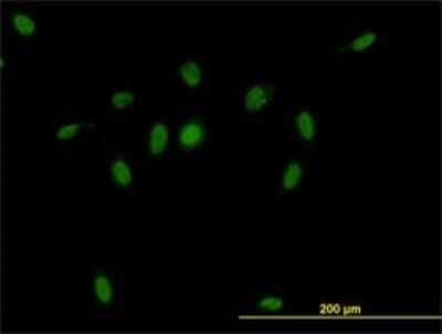Immunocytochemistry/ Immunofluorescence: CSE1L/CAS/Exportin-2 Antibody (2C10) [H00001434-M03]