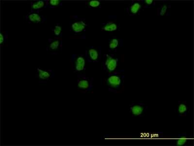 Immunocytochemistry/ Immunofluorescence: CSE1L/CAS/Exportin-2 Antibody (2F4) [H00001434-M04]