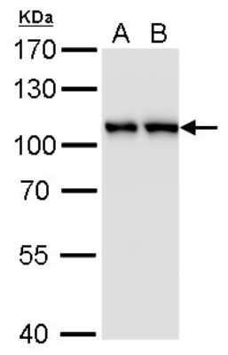 Western Blot: CSE1L/CAS/Exportin-2 Antibody (5111) [NBP2-43609]