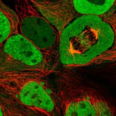Immunocytochemistry/ Immunofluorescence: CSE1L/CAS/Exportin-2 Antibody [NBP2-38383]
