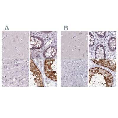 Immunohistochemistry-Paraffin: CSE1L/CAS/Exportin-2 Antibody [NBP2-38384]