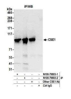 Immunoprecipitation: CSE1L/CAS/Exportin-2 Antibody [NB100-79803]