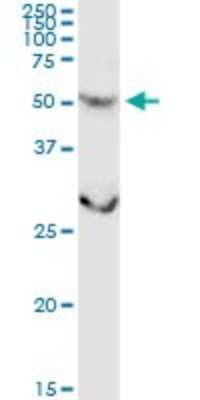 Western Blot: CSGALNACT2 Antibody [H00055454-D01P]