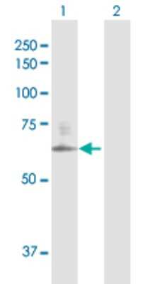 Western Blot: CSGALNACT2 Antibody [H00055454-D01P]