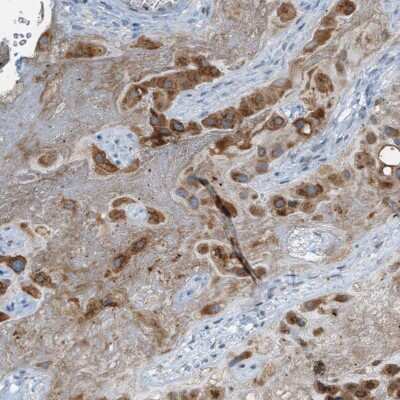 Immunohistochemistry-Paraffin: CSGLCAT Antibody [NBP1-88086]