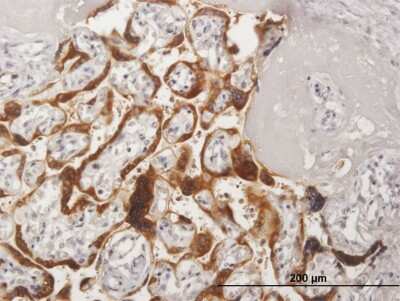 Immunohistochemistry-Paraffin: CSH2 Antibody [H00001443-B02P]
