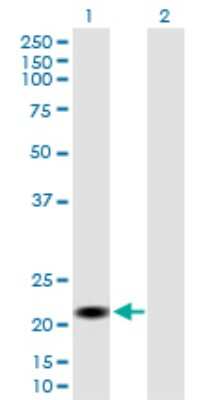 Western Blot: CSH2 Antibody [H00001443-B01P]