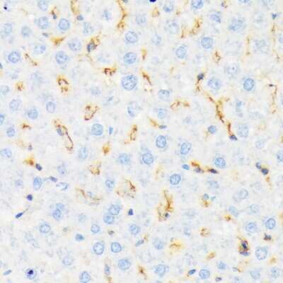 Immunohistochemistry-Paraffin: CSK Antibody (1A2F5) [NBP3-15297]