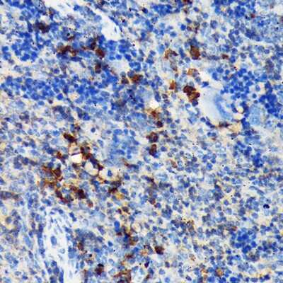 Immunohistochemistry-Paraffin: CSK Antibody (1A2F5) [NBP3-15297]