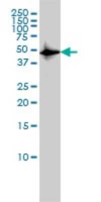 Western Blot: CSK Antibody (3A3) [H00001445-M01]