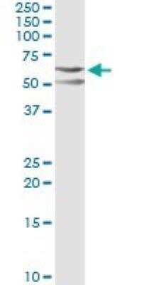 Western Blot: CSK Antibody (3A3) [H00001445-M01]