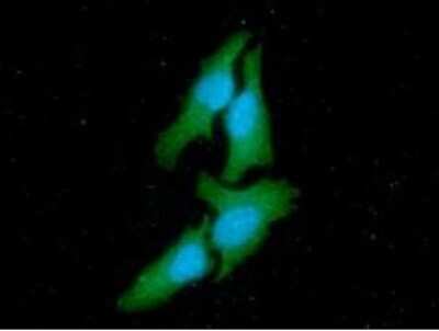 Immunocytochemistry/ Immunofluorescence: CSK Antibody (7C6) - BSA Free [NBP2-59500]