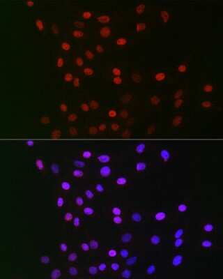 Immunocytochemistry/ Immunofluorescence: CSN1 Antibody - BSA Free [NBP2-92907]