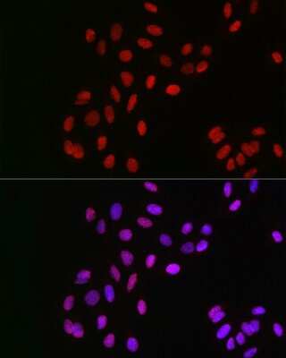 Immunocytochemistry/ Immunofluorescence: CSN1 Antibody - BSA Free [NBP2-92907]