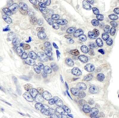 Immunohistochemistry: CSN1 Antibody [NB100-362]
