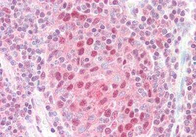 Immunohistochemistry-Paraffin: CSN1 Antibody [NB100-1237]
