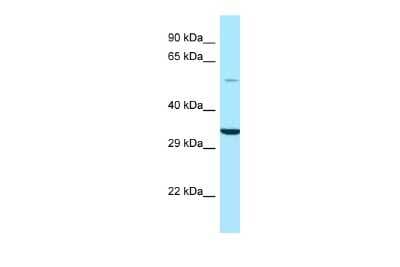 Western Blot: CSN1 Antibody [NBP2-88633]