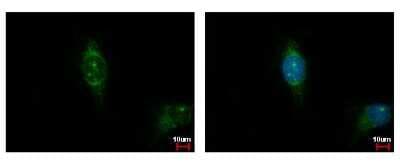 Immunocytochemistry/ Immunofluorescence: CSNK1A1L Antibody [NBP2-16020]