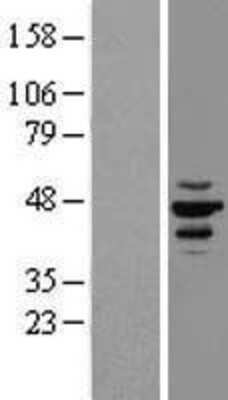 Western Blot: Casein Kinase 1 epsilon Overexpression Lysate [NBL1-09531]