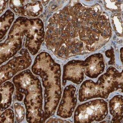 Immunohistochemistry: CSP Antibody [NBP1-87975]