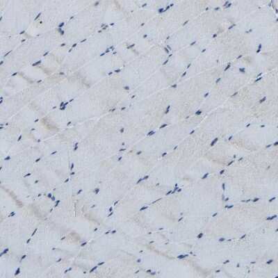 Immunohistochemistry-Paraffin: CSP Antibody [NBP1-87974]