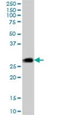 Western Blot: CSP Antibody [H00080331-B01P]