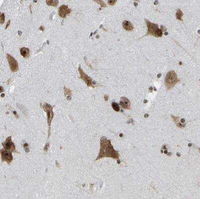 Immunohistochemistry-Paraffin: CSRNP3 Antibody [NBP1-83933]