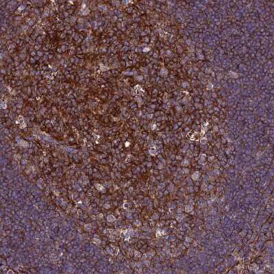 Immunohistochemistry-Paraffin: CSRP2 Antibody [NBP2-13879]