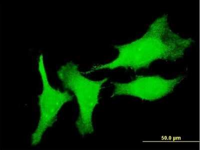 Immunocytochemistry/ Immunofluorescence: CSRP3 Antibody (6D2) [H00008048-M03]