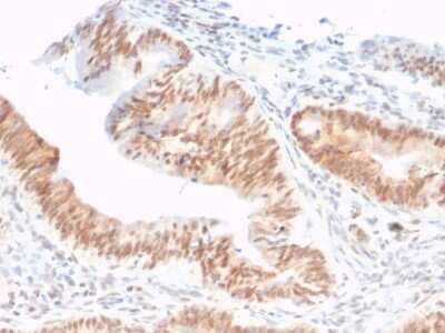 Immunohistochemistry-Paraffin: CSTF2T Antibody (PCRP-CSTF2T-1A3) [NBP3-07486]