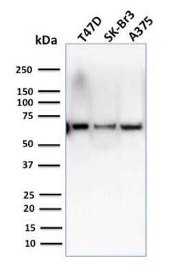 Western Blot: CSTF2T Antibody (PCRP-CSTF2T-1A3)Azide and BSA Free [NBP3-08807]